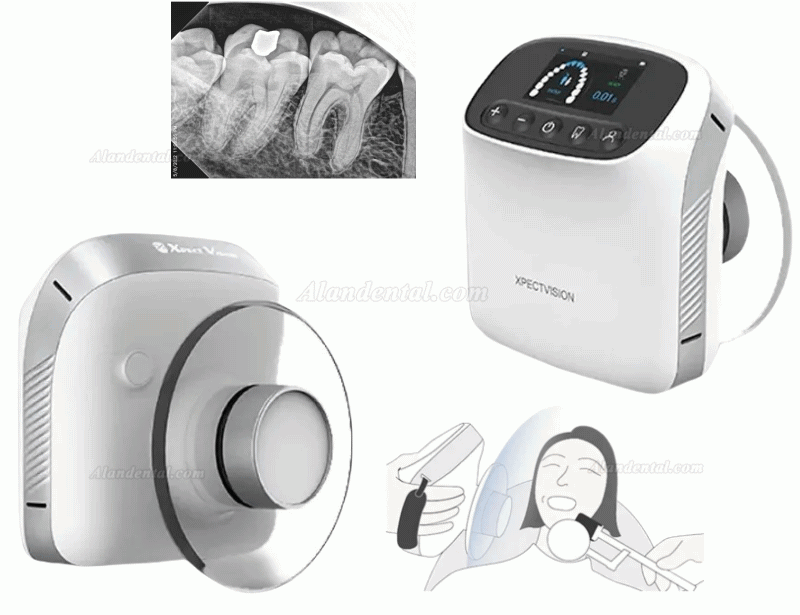 Dental Portable Dental X-Ray Machine Handheld High Frequency X Ray Unit XVbeam2000